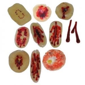 Outdoor wound setP06200